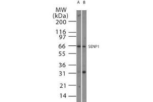 Image no. 1 for anti-SUMO1/sentrin Specific Peptidase 1 (SENP1) (AA 578-590) antibody (ABIN208752) (SENP1 抗体  (AA 578-590))