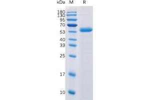 Human CTLA-4 Protein, mFc-His Tag on SDS-PAGE under reducing condition. (CTLA4 Protein (mFc-His Tag))