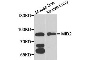 Western blot analysis of extract of mouse liver and mouse lung cells, using MID2 antibody. (Midline 2 抗体)