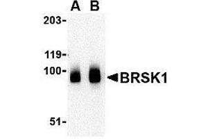Western blot analysis of BRSK1 in human brain tissue lysate with AP30166PU-N BRSK1 antibody at (A) 0. (BRSK1 抗体  (C-Term))