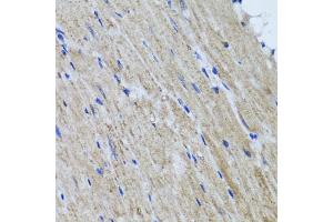 Immunohistochemistry of paraffin-embedded mouse heart using HYAL1 antibody (ABIN5975045) at dilution of 1/100 (40x lens). (HYAL1 抗体)