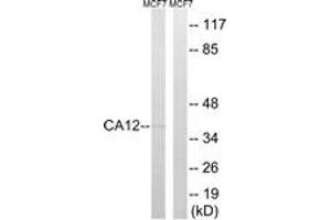 Western blot analysis of extracts from MCF-7 cells, using CA12 Antibody. (CA12 抗体  (AA 231-280))