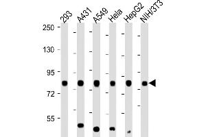 Western Blotting (WB) image for anti-Ribosomal Protein S6 Kinase, 90kDa, Polypeptide 3 (RPS6KA3) (AA 342-376), (Ser369) antibody (ABIN6242552)