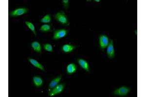 Immunofluorescence staining of Hela cells cells with ABIN7144990 at 1:200, counter-stained with DAPI. (DDX42 抗体  (AA 519-819))