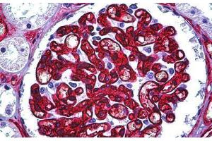 Human Kidney, Glomerulus: Formalin-Fixed, Paraffin-Embedded (FFPE)