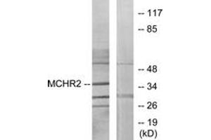 Western Blotting (WB) image for anti-Melanin-Concentrating Hormone Receptor 2 (MCHR2) (AA 291-340) antibody (ABIN2890893)