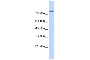 PLD2 antibody used at 5 ug/ml to detect target protein. (Phospholipase D2 抗体  (Middle Region))