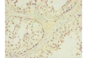 Immunohistochemistry of paraffin-embedded human testis tissue using ABIN7172730 at dilution of 1:100