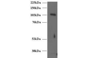 ABIN185243 (2µg/ml) staining of Human T-lymphocyte lysate (35µg protein in RIPA buffer). (UNC13D 抗体  (C-Term))
