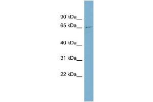 WB Suggested Anti-ZNF18 Antibody Titration:  0. (ZNF18 抗体  (Middle Region))