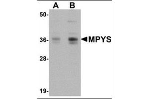 Western blot analysis of MPYS in A-20 cell lysate with AP30565PU-N MPYS antibody at 1 µg/ml (A) and 2 μg/ml (B). (STING/TMEM173 抗体  (C-Term))