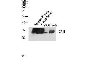 Western Blot (WB) analysis of Mouse Kidney Mouse Brain 293T HeLa lysis using CA II antibody.