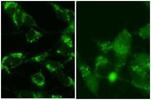 Immunofluorescence (IF) image for anti-Microtubule-Associated Protein 1 Light Chain 3 beta (MAP1LC3B) (AA 96-125), (C-Term), (cleaved) antibody (ABIN1449601)