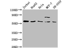 Western Blot Positive WB detected in: Jurkat whole cell lysate, HepG2 whole cell lysate, Hela whole cell lysate, MCF-7 whole cell lysate, SH-SY5Y whole cell lysate All lanes: SLC37A2 antibody at 1:2000 Secondary Goat polyclonal to rabbit IgG at 1/50000 dilution Predicted band size: 55, 43, 14 kDa Observed band size: 55 kDa (SLC37A2 抗体  (AA 46-84))