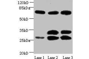 Western blot All lanes: Amyloid beta A4 antibody at 1 μg/mL Lane 1: Mouse heart tissue Lane 2: Mouse kidney tissue Lane 3: Mouse lung tissue Secondary Goat polyclonal to Mouse IgG at 1/15000 dilution Predicted band size: 30, 35, 72, 80 kDa Observed band size: 30, 35, 72 kDa (APP 抗体)
