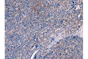 Immunohistochemistry (IHC) image for anti-Keratin 19 (KRT19) (AA 245-391) antibody (ABIN7427978)
