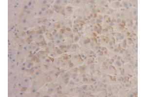 DAB staining on IHC-P; Samples: Human Liver Tissue (IFNA4 抗体  (AA 10-163))
