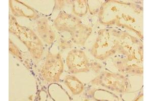 Immunohistochemistry of paraffin-embedded human kidney tissue using ABIN7148068 at dilution of 1:100 (CCDC112 抗体  (AA 201-446))