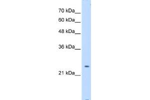 WB Suggested Anti-PTPN2 Antibody Titration:  0. (PTPN2 抗体  (Middle Region))