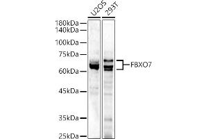 Western blot analysis of extracts of various cell lines, using FBXO7 antibody (ABIN6130383, ABIN6140527, ABIN6140528 and ABIN6223349) at 1:500 dilution. (FBXO7 抗体  (AA 353-522))