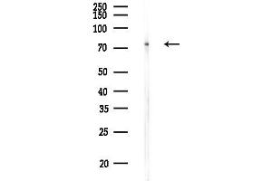 Western blot analysis of lysates from F10-LUC cells, using ABC Antibody at 1/1000 dilution.
