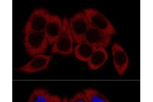 Confocal immunofluorescence analysis of HeLa cells using RPL23 Polyclonal Antibody at dilution of 1:200. (RPL23 抗体)