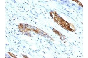 anti-ABO, Blood Group A Antigen antibody