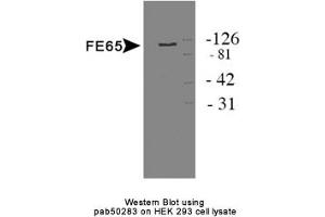 Image no. 1 for anti-Amyloid beta (A4) Precursor Protein-Binding, Family B, Member 1 (Fe65) (APBB1) antibody (ABIN363592)