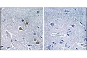 Immunohistochemistry analysis of paraffin-embedded human brain tissue, using ARRDC2 Antibody. (ARRDC2 抗体  (AA 141-190))