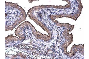 IHC-P Image Cytokeratin 20 antibody [N2C2], Internal detects Cytokeratin 20 protein at cytoplasm on mouse urinary bladder by immunohistochemical analysis.