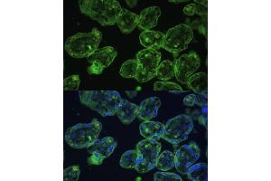 Immunofluorescence analysis of human placenta using Cytokeratin 13 (Cytokeratin 13 (KRT13)) Polyclonal Antibody (ABIN7268090) at dilution of 1:100 (40x lens). (Cytokeratin 13 抗体  (AA 269-458))