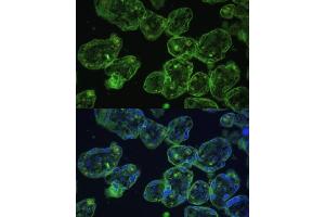 Immunofluorescence analysis of human placenta using Cytokeratin 13 (Cytokeratin 13 (KRT13)) Polyclonal Antibody (ABIN7268090) at dilution of 1:100 (40x lens). (Cytokeratin 13 抗体  (AA 269-458))