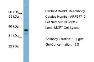 WB Suggested Anti-VPS16  Antibody Titration: 0. (VPS16 抗体  (N-Term))