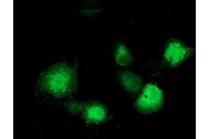 Immunofluorescence (IF) image for anti-Microtubule-Associated Protein, RP/EB Family, Member 2 (MAPRE2) antibody (ABIN1499317) (MAPRE2 抗体)
