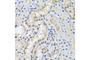 Immunohistochemistry (Paraffin-embedded Sections) (IHC (p)) image for anti-Centrin, EF-Hand Protein, 3 (CETN3) (AA 1-167) antibody (ABIN6138444)
