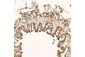 Immunohistochemistry of paraffin-embedded rat lung using [KO Validated]  Rabbit mAb (ABIN7271243) at dilution of 1:100 (40x lens). (AKT1 抗体)