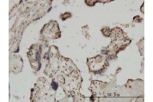 Immunoperoxidase of monoclonal antibody to ZIC4 on formalin-fixed paraffin-embedded human placenta. (ZIC4 抗体  (AA 249-319))