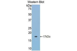 Western Blotting (WB) image for anti-Acid Phosphatase 1, Soluble (ACP1) (AA 40-158) antibody (ABIN1857871)