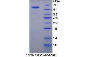 SDS-PAGE analysis of Rat TGM1 Protein. (TGM1 蛋白)