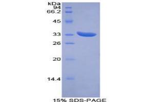 SDS-PAGE analysis of Mouse PINK1 Protein. (PINK1 蛋白)
