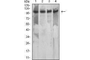 Western Blotting (WB) image for anti-Mismatch Repair Protein 2 (MSH2) (AA 442-586) antibody (ABIN7193508)