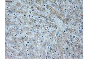 Immunohistochemical staining of paraffin-embedded lymph node tissue using anti-NEUROG1mouse monoclonal antibody. (Neurogenin 1 抗体)