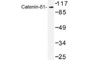 Image no. 1 for anti-Catenin (Cadherin-Associated Protein), delta 1 (CTNND1) antibody (ABIN317789) (CTNND1 抗体)