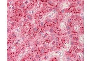 Anti-Beta Galactosidase antibody IHC staining of human liver. (GLB1 抗体  (AA 166-677))