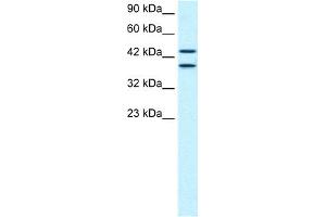 WB Suggested Anti-C14ORF131 Antibody Titration:  0. (ZNF839 抗体  (Middle Region))