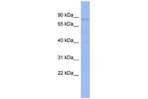 WB Suggested Anti-CNOT3 Antibody Titration:  0. (CNOT3 抗体  (C-Term))