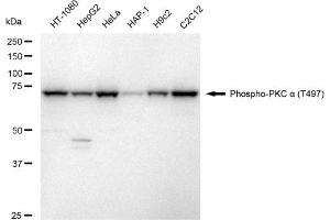 Western blotting analysis using Phospho-PKC alpha (T497) antibody (ABIN7799986).