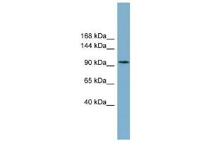 SLC12A3 antibody used at 1 ug/ml to detect target protein. (SLC12A3 抗体)