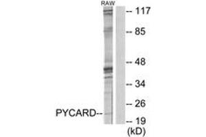 Western blot analysis of extracts from RAW264. (STS 抗体  (AA 10-59))
