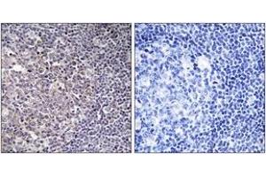 Immunohistochemistry analysis of paraffin-embedded human tonsil tissue, using BCAS4 Antibody. (BCAS4 抗体  (AA 31-80))